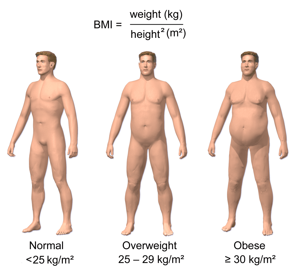 Illustration showing BMI categories: normal, overweight, obese